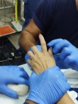 costureira-fica-com-o-dedo-preso-em-maquina-de-costura-em-florianopolis